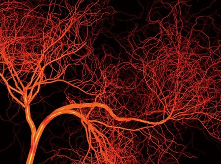 Study finds 3D-printed blood vessels could improve heart bypass outcomes
