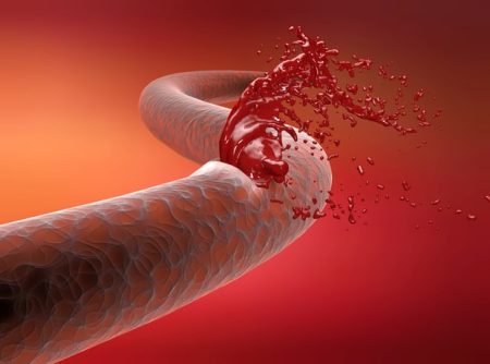 International researchers use shear waves to map blood vessel structures
