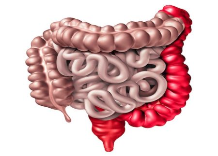 Study identifies new disease-inducing mechanism for inflammatory bowel disease
