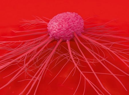 Oncologica to advance urine-based prostate cancer screening test
