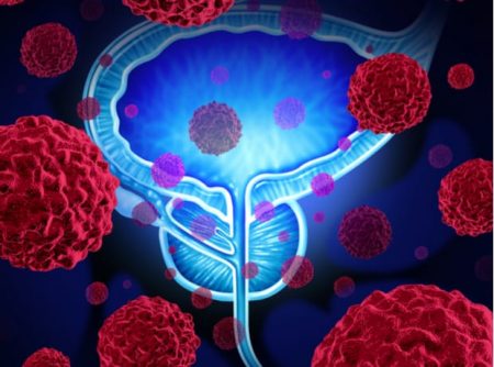 New therapy hope for prostate cancer patients
