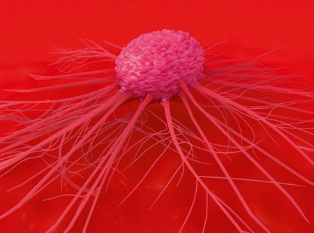 NHS rolls out new initiative to identify pancreatic cancer earlier

