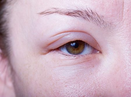 Exonate to launch phase 2b trial of EXN407 for diabetic eye disease

