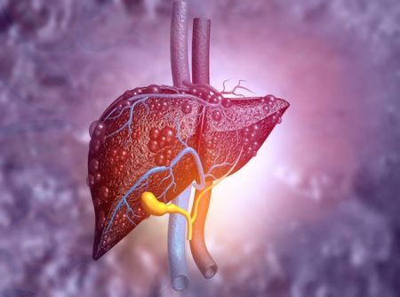 Resolution Therapeutics hails positive 4‑year MATCH data in liver cirrhosis

